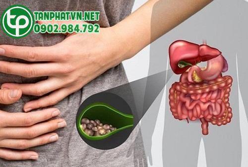 Râu mèo trị sỏi mật hiệu quả