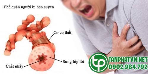 Cây Lá hen Tại Tiền Giang Ở Đâu Cây Lá hen Tại Tiền Giang Ở Đâu