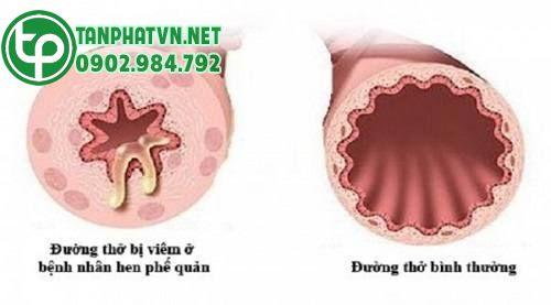 Mua Cây Lá hen Tại Vĩnh Long