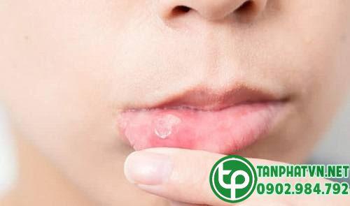 Mua Sá Sùng Khô Tại Long An Ở Đâu