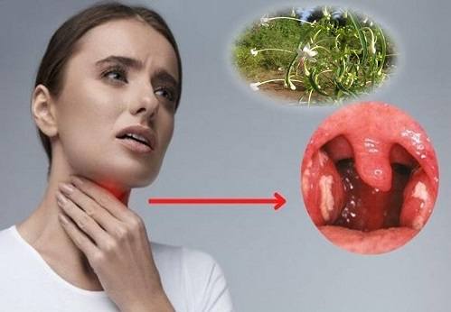 Tác dụng của cây chỉ thiên Tác dụng của cây chỉ thiên