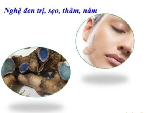 Tác dụng của nga truật