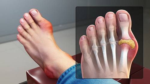 Cách sử dụng tơm trơng đơn giản tại nhà Cách sử dụng tơm trơng đơn giản tại nhà