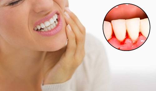Tác dụng của hạt cau khô 