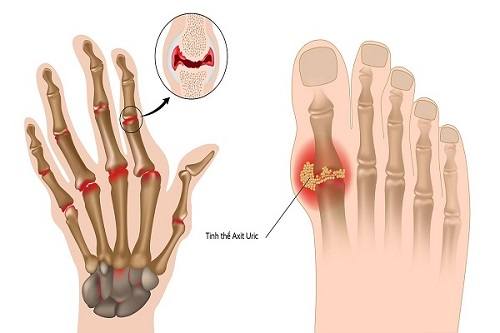 Công dụng của cây tơm trơng 