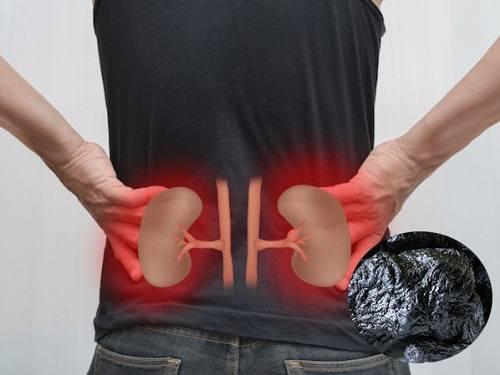 Công dụng của thục địa Công dụng của thục địa