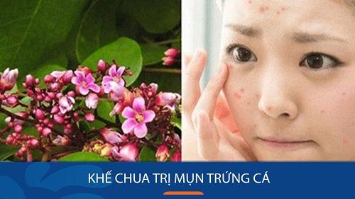 Lá khế giúp trị mụn