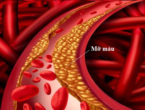 Mỡ máu trong cơ thể