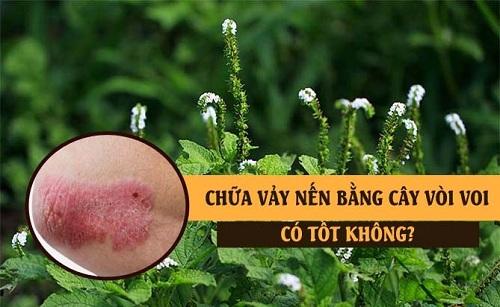 Cây vòi voi trị vảy nến