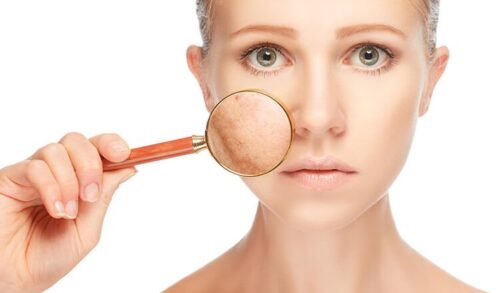 Những vấn đề da thường gặp