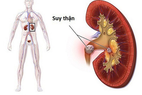 Thục địa giúp bổ thận tráng dương