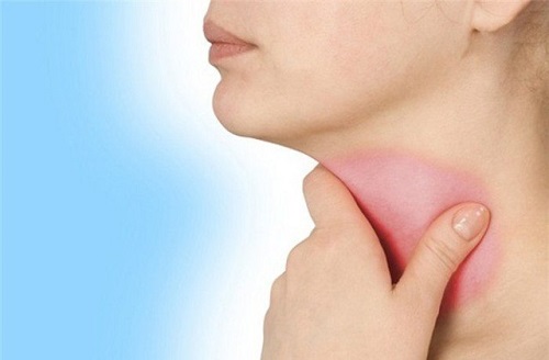 Bạch cương tằm giá rẻ trị đau họng