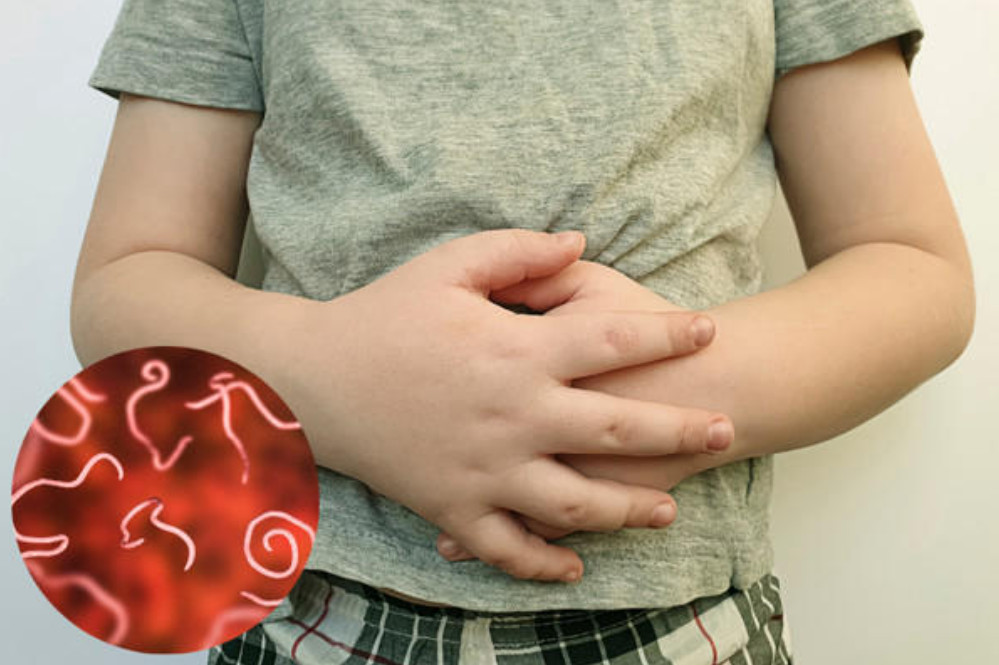 Hạt keo dậu tại TP.HCM hỗ trợ tẩy giun