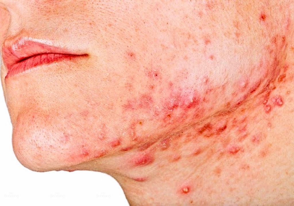 Đối tượng phù hợp uống trà cam thảo
