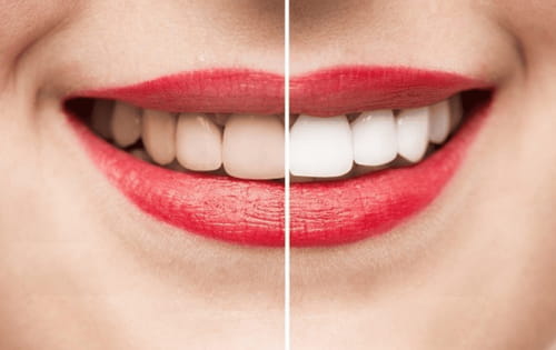 Trà bạc hà giúp chăm sóc răng miệng