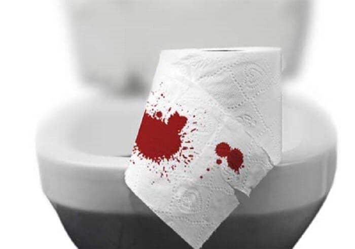Lưu ý khi dùng trà túi lọc lá đơn đỏ trị đại tiện ra máu