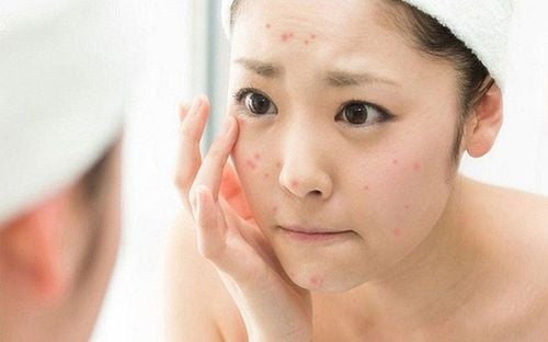 Uống nhiều trà túi lọc bạc hà gây rối loạn nội tiết tố