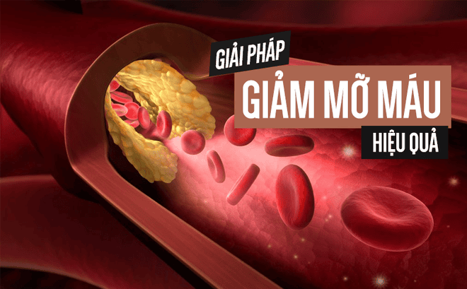 Người bị mỡ máu cao thường gặp vấn đề gì ?