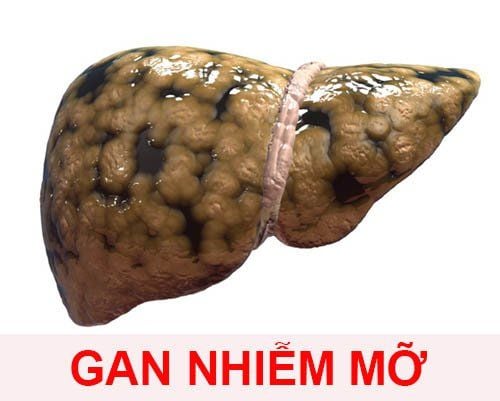 Trà lá nam trị gan nhiễm mỡ