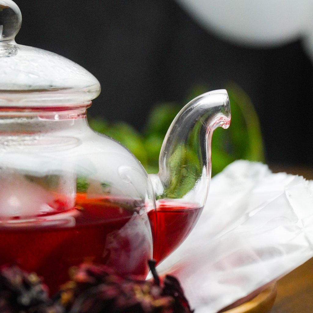 Lưu ý cho người bị sỏi mật