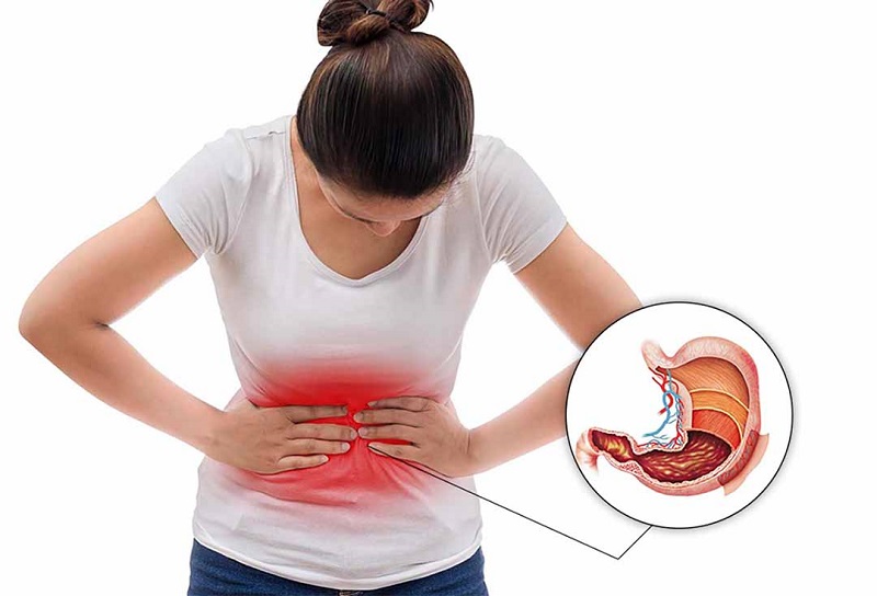 Đau bao tử là gì ?